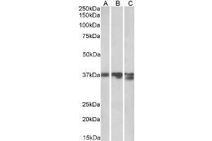 Image no. 3 for anti-Arginase, Liver (ARG1) (C-Term) antibody (ABIN570917)