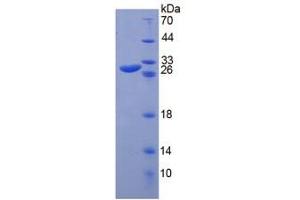 Image no. 1 for Chitinase 3-Like 1 (Cartilage Glycoprotein-39) (CHI3L1) (AA 117-364) protein (His tag) (ABIN6237732)