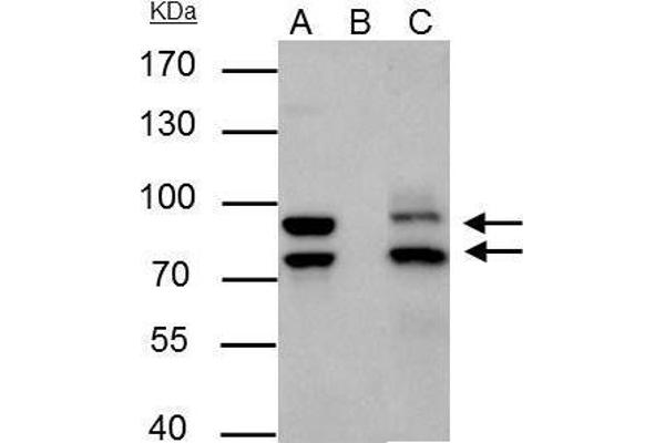 anti-Mdm2, p53 E3 Ubiquitin Protein Ligase Homolog (Mouse) (MDM2) (Center) antibody