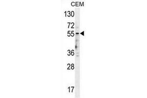 Image no. 2 for anti-Serotonin Receptor 3E (HTR3E) (AA 133-162), (Middle Region) antibody (ABIN954737)