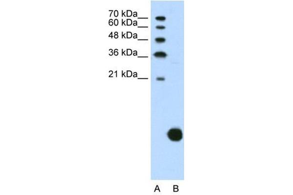anti-Ribosomal Protein S29 (RPS29) (N-Term) antibody