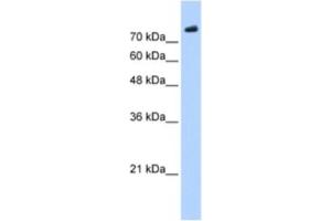 Image no. 1 for anti-PHD Finger Protein 20 (PHF20) antibody (ABIN2461244)