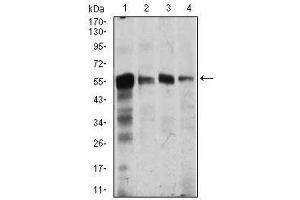 Image no. 4 for anti-Calcium/calmodulin-Dependent Protein Kinase IV (CAMK4) antibody (ABIN1491438)