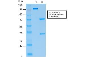 Image no. 2 for anti-Paired Box 5 (PAX5) antibody (ABIN6940254)
