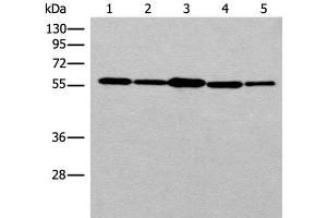 Western blot analysis of 293T cell HUVEC cell Hela cell lysates using RAD23B Polyclonal Antibody at dilution of 1:350