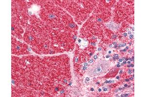 Image no. 2 for anti-Disrupted in Schizophrenia 1 (DISC1) (C-Term) antibody (ABIN351527)