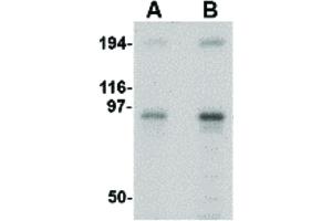 Image no. 1 for anti-Nucleoporin 107kDa (NUP107) (Internal Region) antibody (ABIN6656560)