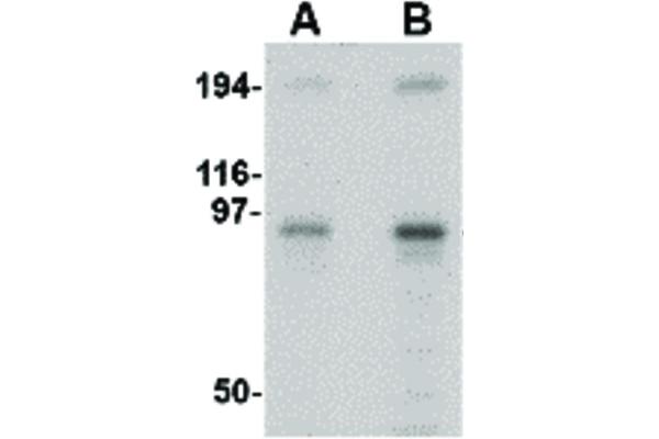 anti-Nucleoporin 107kDa (NUP107) (Internal Region) antibody