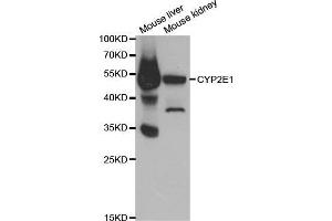 CYP2E1 抗体  (AA 234-493)