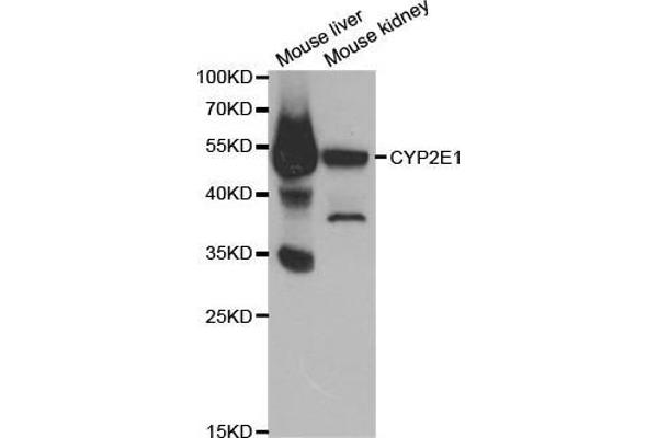 CYP2E1 Antikörper  (AA 234-493)