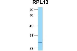 Image no. 5 for anti-Ribosomal Protein L13 (RPL13) (C-Term) antibody (ABIN2778677)