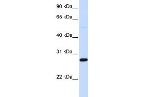 Image no. 1 for anti-Deoxycytidine Kinase (DCK) (Middle Region) antibody (ABIN2784622)