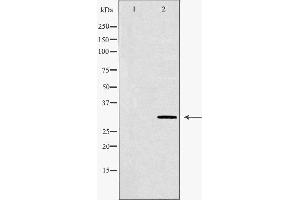 Image no. 1 for anti-Pancreatic and Duodenal Homeobox 1 (PDX1) (Internal Region) antibody (ABIN6266306)
