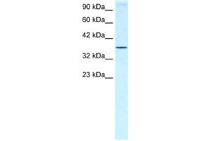 Image no. 1 for anti-Homeobox A7 (HOXA7) (N-Term) antibody (ABIN2779767)