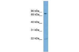 Image no. 1 for anti-Glutamine-Fructose-6-Phosphate Transaminase 2 (GFPT2) (N-Term) antibody (ABIN2775297)