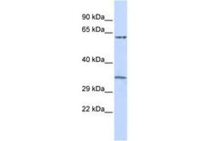 Image no. 1 for anti-Tripartite Motif Containing 8 (TRIM8) (AA 360-409) antibody (ABIN6740390)