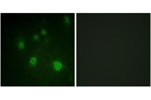 Immunofluorescence analysis of COS7 cells, using HMG14 (Phospho-Ser21) Antibody.