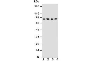 Western blot testing of NRG2 antibody and Lane 1:  rat liver;  2: human COLO320;  3: SMMC-7721;  4: SW620 cell lysate.