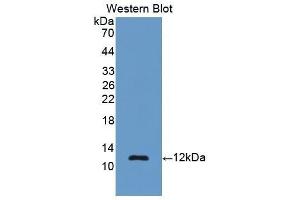 Image no. 1 for anti-Renin (REN) (AA 144-237) antibody (ABIN1860432)
