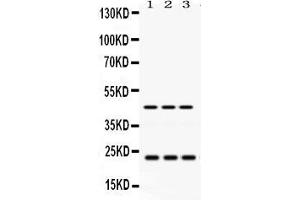 Image no. 4 for anti-RAB13, Member RAS Oncogene Family (RAB13) (AA 121-150), (C-Term) antibody (ABIN3043916)