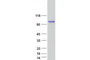 Image no. 1 for Archaelysin Family Metallopeptidase 1 (AMZ1) protein (Myc-DYKDDDDK Tag) (ABIN2714678)