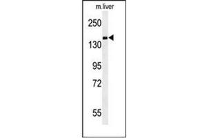 Image no. 2 for anti-phosphodiesterase 6C, CGMP-Specific, Cone, alpha Prime (PDE6C) (AA 278-308), (Middle Region) antibody (ABIN954067)