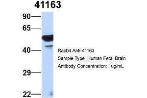 Image no. 4 for anti-Septin 11 (SEPT11) (N-Term) antibody (ABIN2787099)