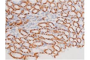 Image no. 10 for anti-Spleen tyrosine Kinase (SYK) (pTyr348) antibody (ABIN6255895)