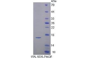 Image no. 1 for Cystatin C (CST3) (AA 21-140) protein (T7 tag,His tag) (ABIN6236703)