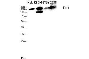 Image no. 2 for anti-Fms-Related tyrosine Kinase 1 (VEGFR1) (FLT1) (Ser385) antibody (ABIN3184639)