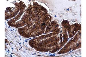 IHC-P Image E-Cadherin antibody detects E-Cadherin protein at cell membrane and cytoplasm in mouse prostate by immunohistochemical analysis.