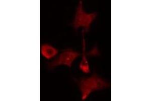 Image no. 2 for anti-MAD2L1 Binding Protein (MAD2L1BP) antibody (ABIN6257316)
