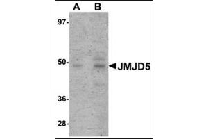 Image no. 2 for anti-Jumonji Domain Containing 5 (JMJD5) (C-Term) antibody (ABIN500086)