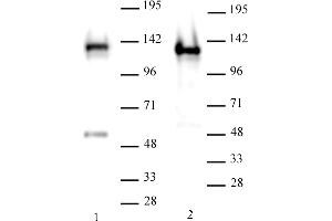 Image no. 1 for anti-SWI/SNF Related, Matrix Associated, Actin Dependent Regulator of Chromatin, Subfamily A, Member 1 (SMARCA1) (AA 571-772) antibody (ABIN6972729)