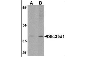 Image no. 1 for anti-Solute Carrier Family 35 (UDP-Glucuronic Acid/UDP-N-Acetylgalactosamine Dual Transporter), Member D1 (SLC35D1) (N-Term) antibody (ABIN500742)