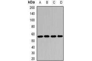 Image no. 1 for anti-3-Oxoacid CoA Transferase 1 (OXCT1) (full length) antibody (ABIN6004560)
