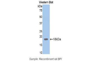 Image no. 1 for anti-Bactericidal/Permeability Increasing Protein (BPI) (AA 320-452) antibody (ABIN1174389)
