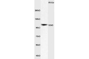 Image no. 3 for anti-Low Density Lipoprotein Receptor-Related Protein 8, Apolipoprotein E Receptor (LRP8) (AA 851-963) antibody (ABIN719426)