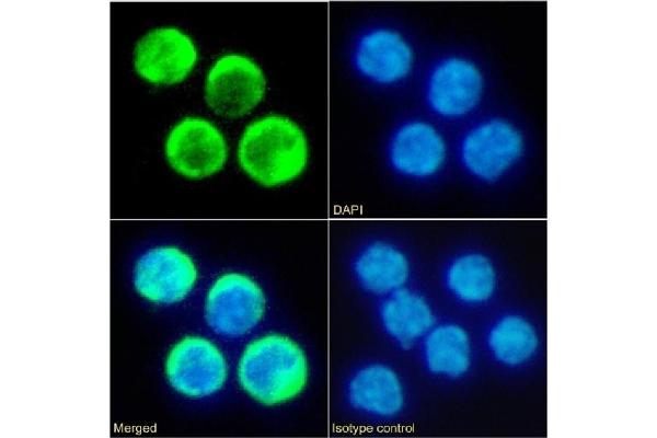TIMD2 抗体  (Extracellular Domain)