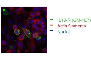 Image no. 6 for anti-Interleukin 13 Receptor, alpha 1 (IL13RA1) (Extracellular Domain) antibody (ABIN108718)