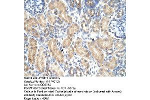 Rabbit Anti-PRMT1 Antibody  Paraffin Embedded Tissue: Human Kidney Cellular Data: Epithelial cells of renal tubule Antibody Concentration: 4.