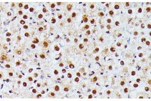 Immunohistochemistry of paraffin-embedded Rat ovary using ID2 Polyclonal Antibody at dilution of 1:100 (40x lens).