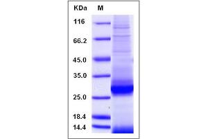 Image no. 1 for Apolipoprotein A-I (APOA1) (AA 1-264) protein (His tag) (ABIN2008406)