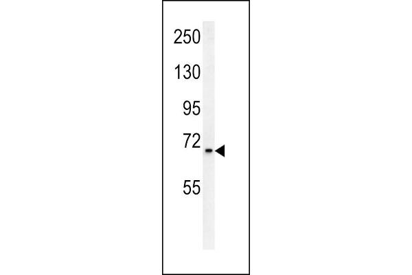 SLC25A12 antibody  (N-Term)