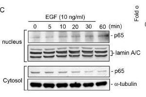 Nuclear factor (NF)-κB is involved in epidermal growth factor (EGF)-induced heme oxygenase (HO)-1 expression in HT-29 cells.