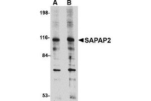 Image no. 1 for anti-Discs, Large (Drosophila) Homolog-Associated Protein 2 (DLGAP2) (Middle Region) antibody (ABIN1031077)