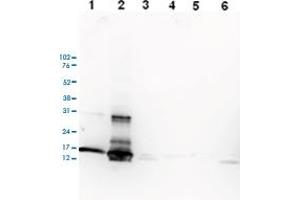 Image no. 3 for anti-Histone Cluster 1, H3a (HIST1H3A) (3meLys27) antibody (ABIN5773864)