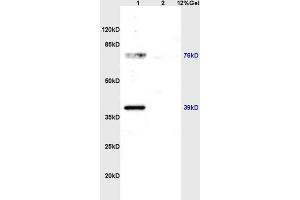 Image no. 1 for anti-Zinc Finger Protein 185 (ZNF185) (AA 551-650) antibody (ABIN762716)
