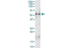 Image no. 1 for anti-Interleukin 13 Receptor, alpha 2 (IL13RA2) (AA 1-380) antibody (ABIN517122)