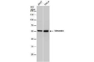 WB Image Vimentin antibody detects Vimentin protein by western blot analysis.